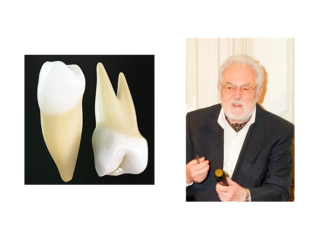矯正治療における便宜抜歯について（２）　画像