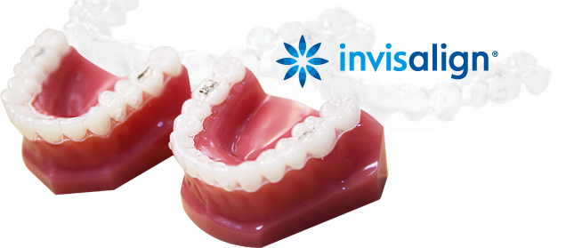 invisalign