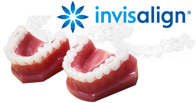 invisalign