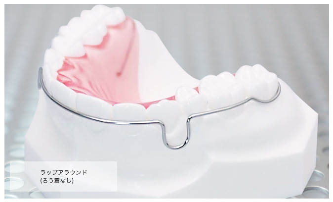 リテーナー(保定装置)?*