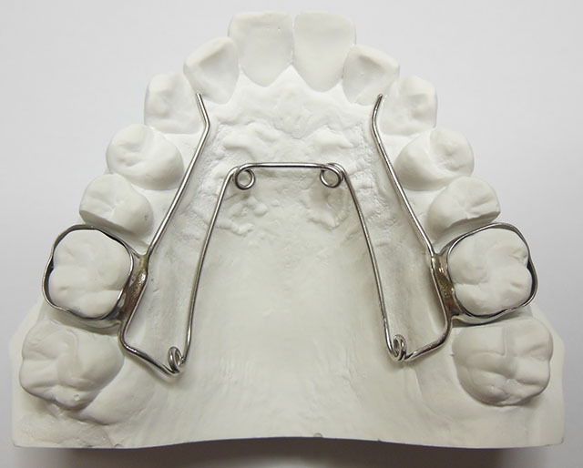 矯正装置１?(固定式)